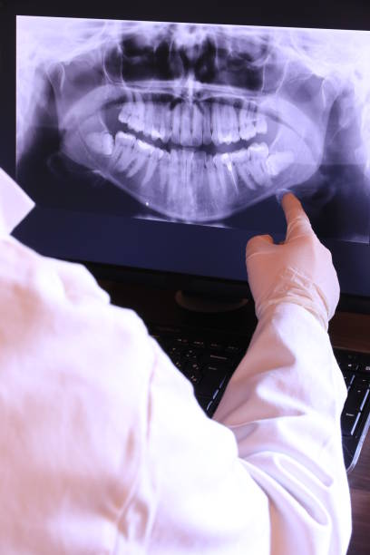 Best Emergency Treatment for Dental Infections or Abscesses in Captain Cook, HI