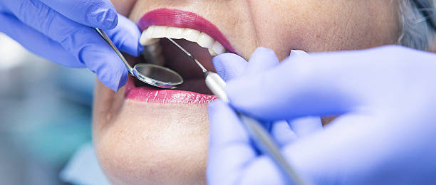 Best Emergency Dental Care for Broken or Chipped Teeth in Captain Cook, HI